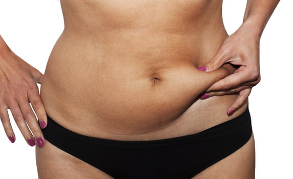 How Long Does It Take to Recover From Liposuction?