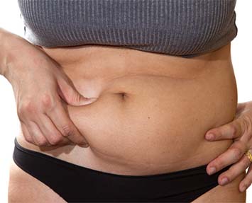 Coolsculpting Treatment at Evolve